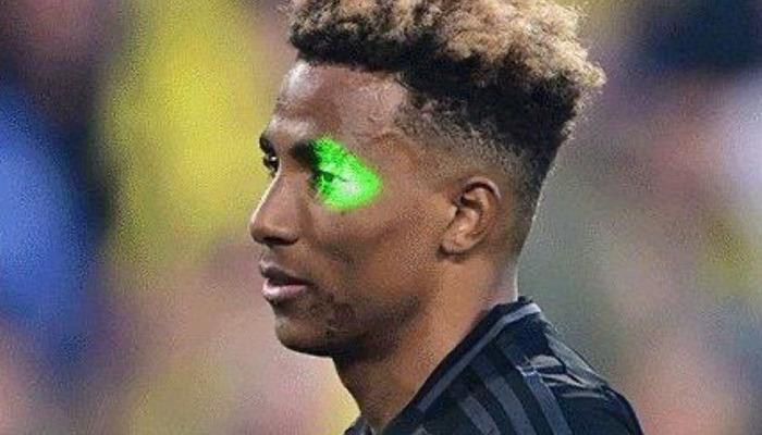 Fenerbahce-Besiktas maçı Gedson’ın göz lazeri yapıldı! Bu hayranlarla ilgili yeni gelişme